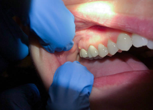 Best Emergency Care for Gum Disease in Burley, ID