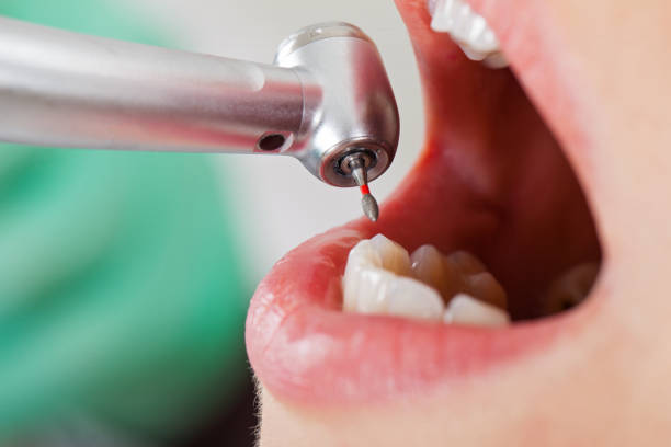Best Emergency Orthodontic Repairs in Burley, ID